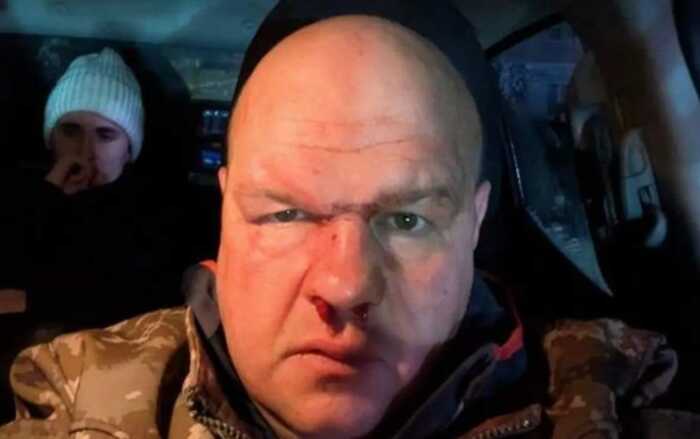 Скандал на Тернопільщині: мажори після ДТП побили військового та намагалися зам’яти справу через ТЦК